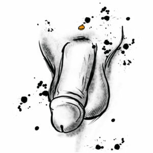 Intim mann dermal 300x300